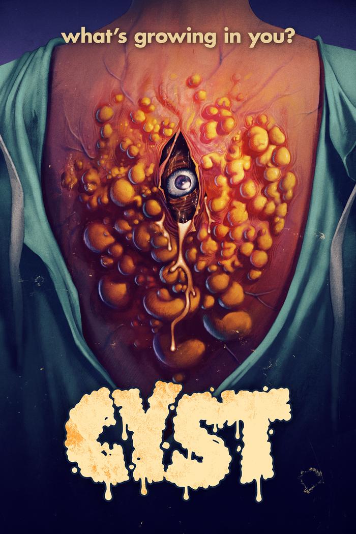 Affisch: Cyst